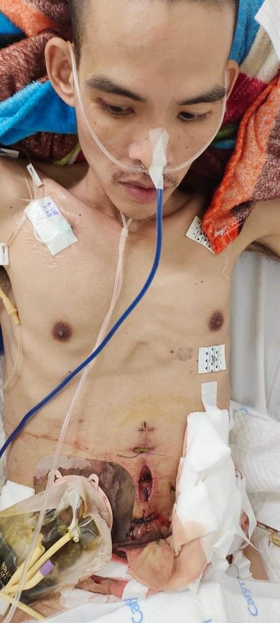 Hình ảnh anh Lâm Văn Học đang điều trị tại bệnh viện